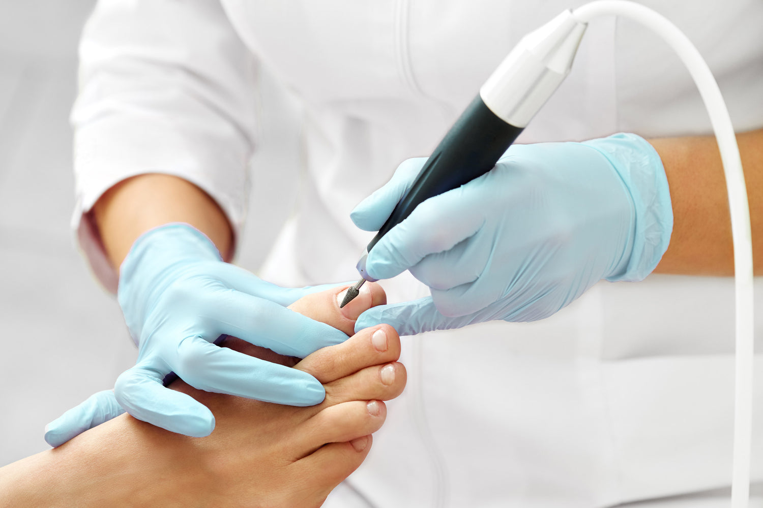 Podiatrist debriding a toenail using a diamond bur